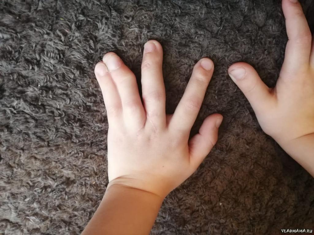 Левой руке нужна операция