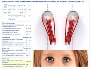 Глаза после операции